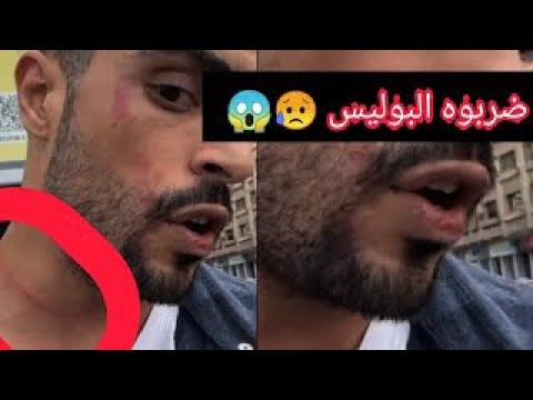 #rapmusic #rapper #music OUENZA - DERBOH BOLICE LIVE INSTAGRAM 😨@OUENZA وانزة ..ضربو بوليسي😢