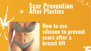 BREAST LIFT SCAR THERAPY | HOW TO USE SILICONE FOR SCAR TREATMENT  AFTER PLASTICS #plasticsurgery