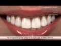 video thumbnail (2)