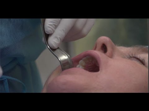 All-On-4 Dental Implants with Oral Surgeon Dr. John Wallace