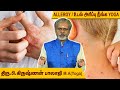 உடலில் Skin Allergy Rashes அரிப்பை மாத்திரைகள் இ�
