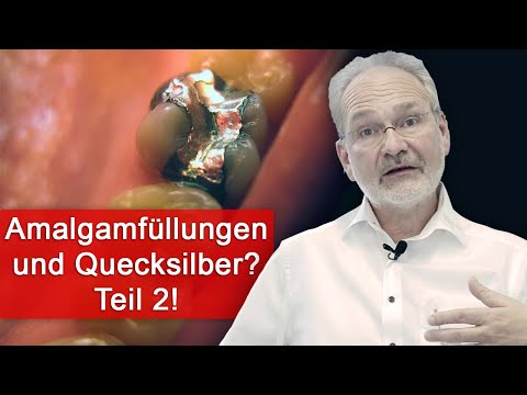 Quecksilber in Amalgamfüllungen - Geführte Betrachtung von Studien mit Dr. Wiechert!