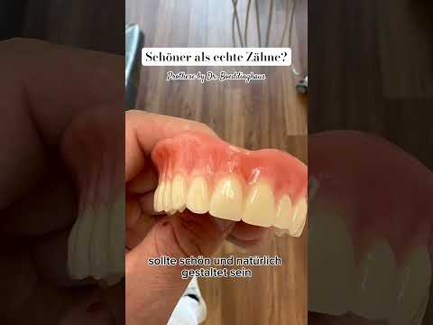 ZAHNERSATZ schöner als echte Zähne? #zahnersatz #zahnprothese #schönezähne #zahnarzt