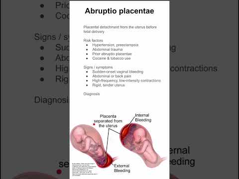 Abruptio placentae