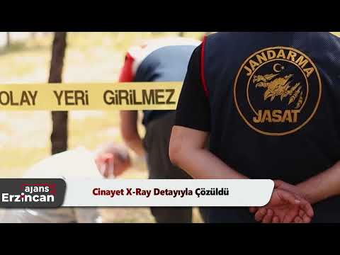 Cinayet X-Ray Detayıyla Çözüldü