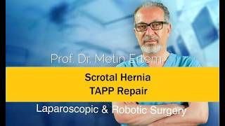 Miniaturka - Scrotal Hernia TAPP Repair. Metin Ertem MD.FACS