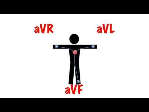 ECG: Cardiac Axis