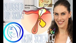 WHY DOES MY SKIN GET CLOGGED, AND HOW TO GET RID OF CLOGGED PORES | Skin Science Episode 6