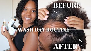 HOW TO GET RID OF SCALP PSORIASIS WASH DAY ROUTINE FT. LAVISH CURLS BEAUTY