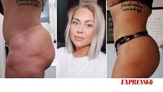 Minidokumentär: Brazilian Butt Lift - En rumpa att dö för