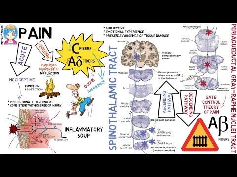 INSTANT NEURO - Pain
