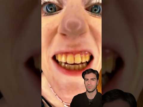 Fix These YELLOW Teeth