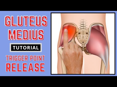 Trigger Point Release - Gluteus Medius