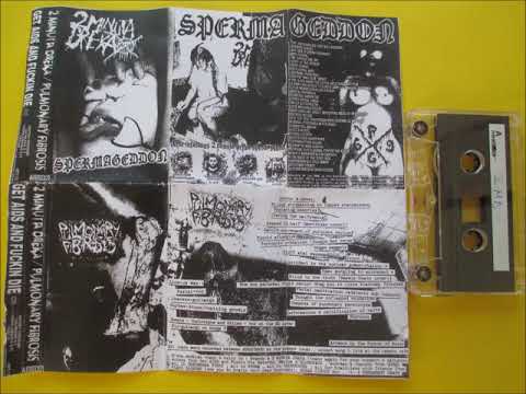 2 MINUTA DREKA / PULMONARY FIBROSIS - split (tape rip)