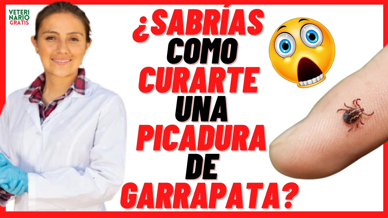 Watch đ” ¿CĂMO CURAR LA PICADURA DE GARRAPATA DE PERRO EN HUMANOS đ”SĂntomas y Tratamiento Now đ” ¿CĂMO CURAR LA PICADURA DE GARRAPATA DE PERRO EN HUMANOS đ”SĂntomas y Tratamiento