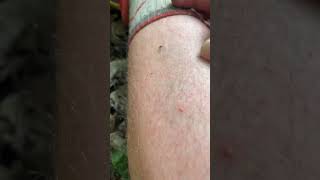 Download lagu Tarp versus Tent Camping mp3