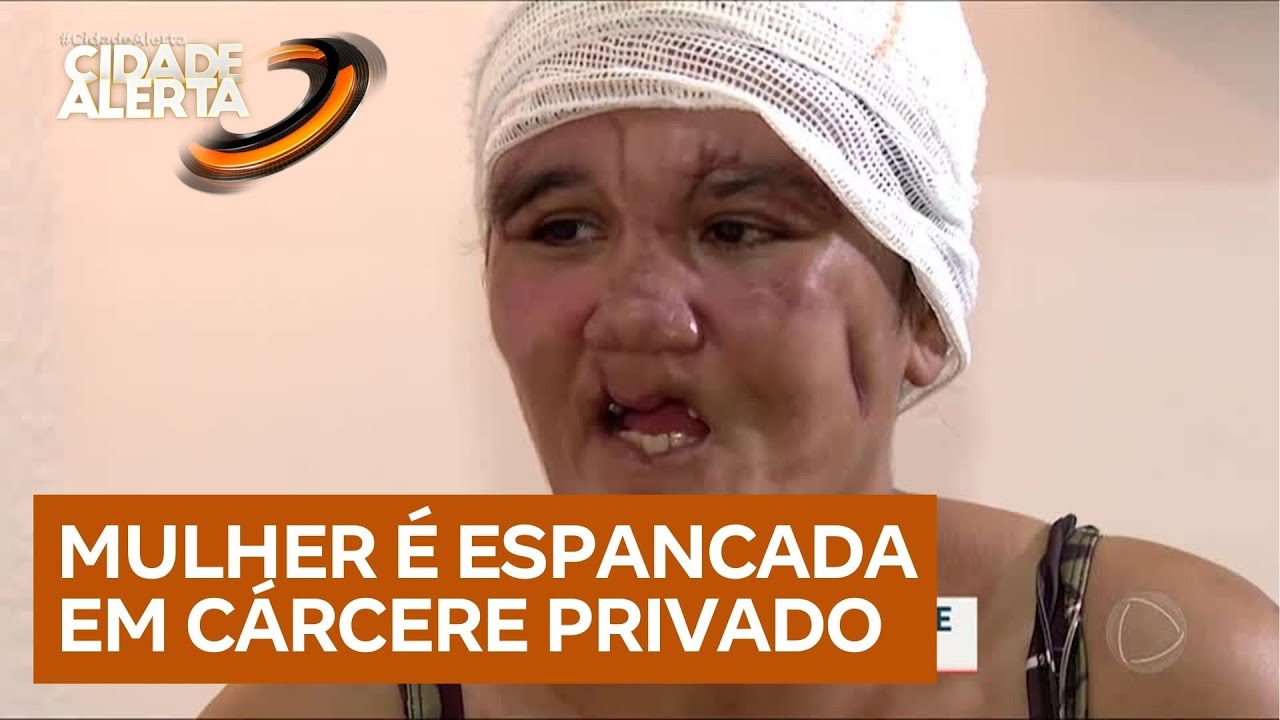 SOS Mulheres: Mulher quebra o silêncio após ser agredida e mantida em cárcere privado pelo marido