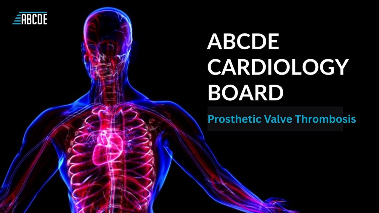 Prosthetic Valve Thrombosis — What Every Future Cardiologist Must Know | ABCDE Cardiology board