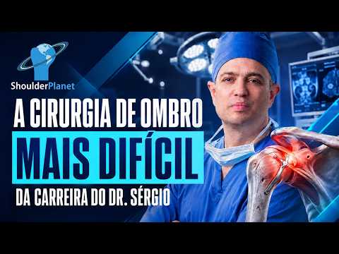 Como foi a cirurgia de ombro mais difícil que o Dr. Sérgio Médico Ortopedista fez na sua carreira