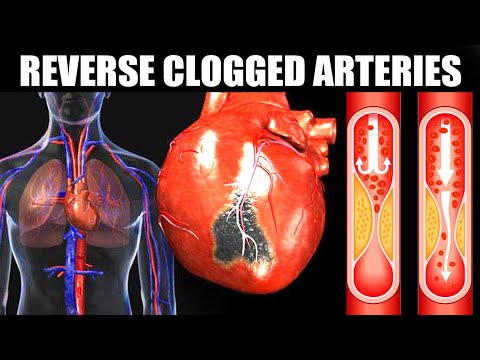 1 GLASS OF THIS JUICE IN THE MORNING! REVERSE CLOGGED ARTERIES & LOWER HIGH BLOOD PRESSURE