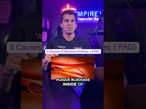 5 Causes of PAD! #PAD #blockedarteries #arteries