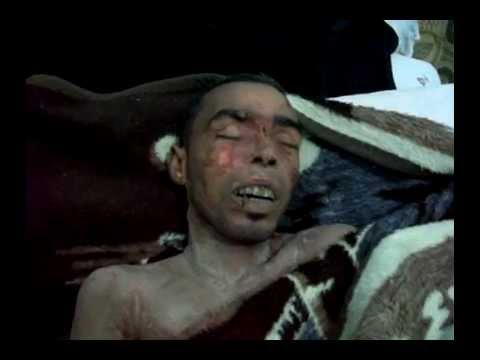 جثمان مصطفى الملاواني أحد عناصر كتيبة أنوار الحق والذي قتل أثناء محاصرة اللواء 93 في عين عيسى في ريف الرقة