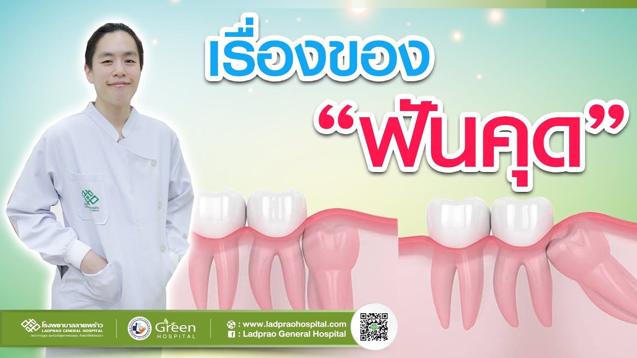 เรื่องของ ฟันคุด