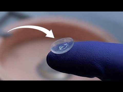 Trailer phim "Giác mạc người in 3D đầu tiên trên thế giới"