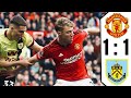 Manchester United vs Burnley 1-1 All Goals & Highlights | premier league 2024