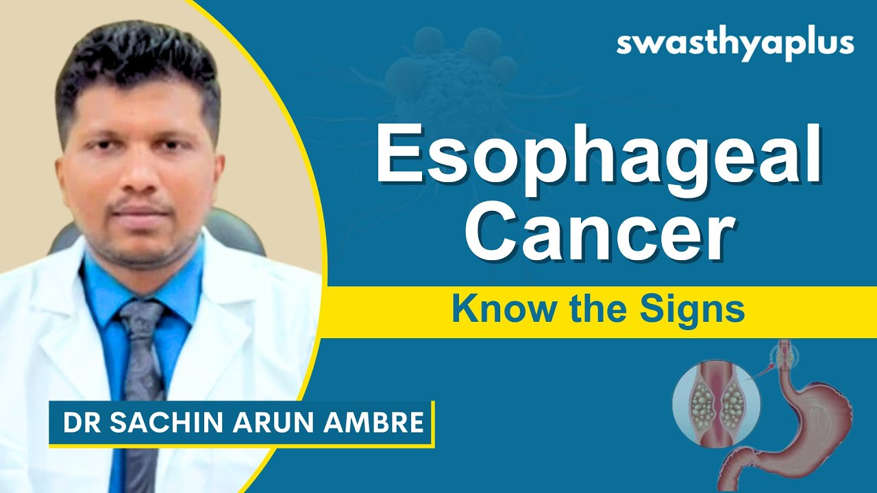 Esophageal Cancer: How to Treat? | Food Pipe Cancer | Symptoms | Dr Sachin Arun Ambre