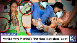 Monika More Mumbai’s First Hand Transplant Patient