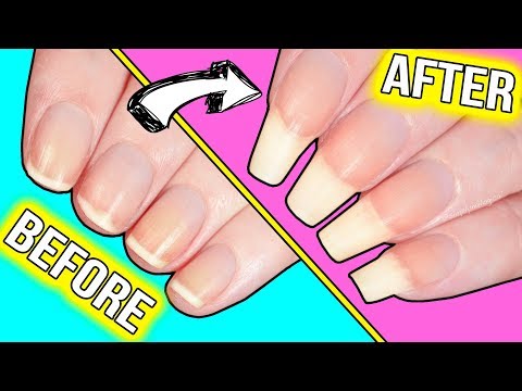 How to GROW YOUR NAILS FAST*!!! (actually helpful information)