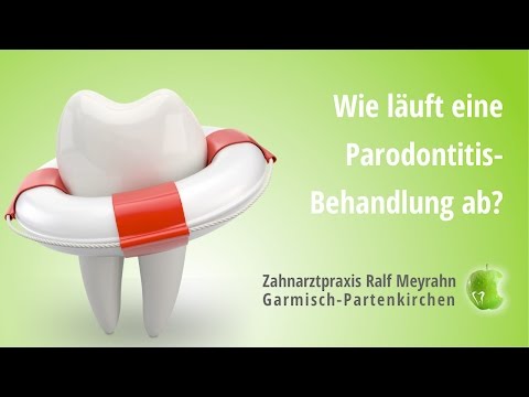 Zahnarzt Garmisch Parodontitis-Behandlung - Ralf Meyrahn