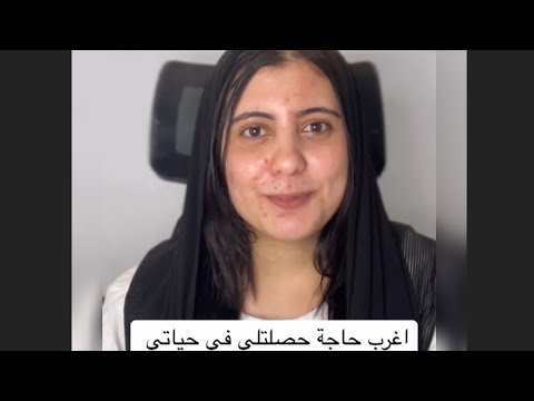 اغرب حاجه حصلتلى فى حياتى🙆العروسه طلبت تطلع الساعه ٢ بليل قالتلى لو مكنتيش وافقتى كنت هعيط🤷🤷