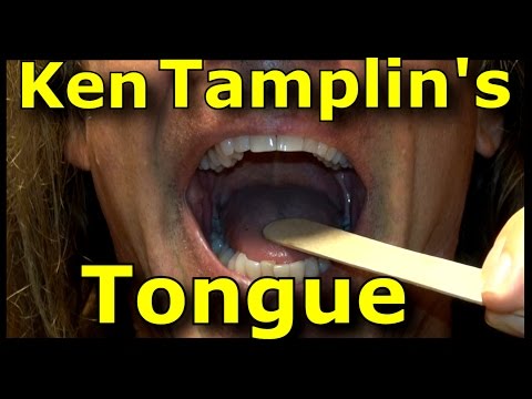 Ken Tamplin's Tongue - Tongue Tension - Placement For Singing - Ken Tamplin Vocal Academy