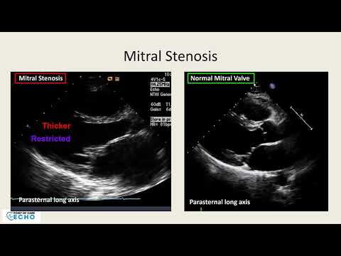 online ecg interpretation course samples