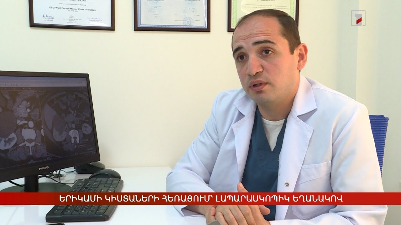 Երիկամի կիստաների հեռացում՝ լապարասկոպիկ եղանակով