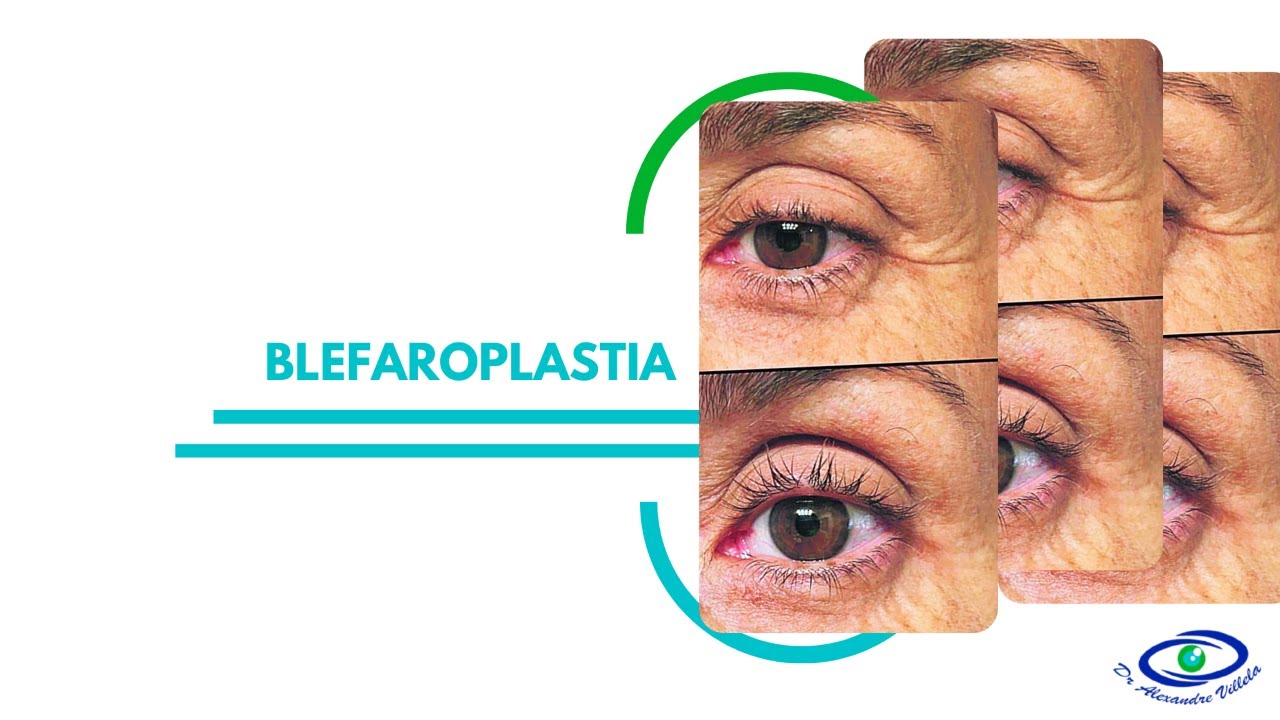 Alexandre Nogueira Villela Salgado-16