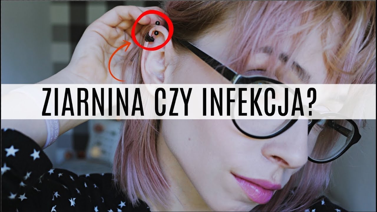 Pozbądź się ZIARNINY i INFEKCJI bez wyjmowania KOLCZYKA