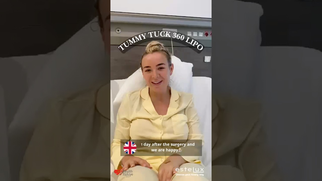estelux istanbul patient testimonial hair transplant