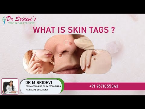 Best Skincare Routine for Oily Skin | Dr. Sridevi