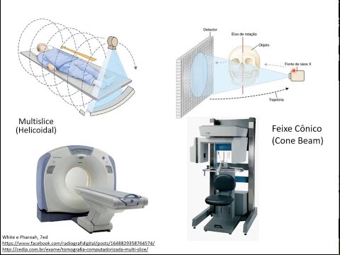 Introduction to Computed Tomography (Part 1 of 3)