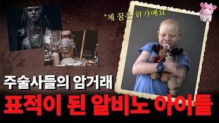 Download lagu 돈을 위해 표적이 된 아이들, 탄자니아 알비노 암거래의 추악한 실체 mp3 Download lagu 돈을 위해 표적이 된 아이들, 탄자니아 알비노 암거래의 추악한 실체 mp3