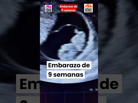 Embarazo de 9 semanas. Latido.