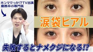 涙袋ヒアル|自然に見せる入れ方【症例写真】