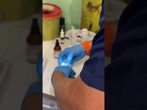 Rinoplasti 5. gün #youtubeshorts #viral #viralvideo #video #viralshorts #music #love #reels #tiktok