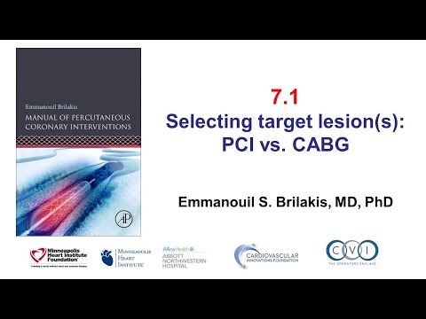 7.1 Manual of PCI - PCI vs. CABG vs. no revascularization