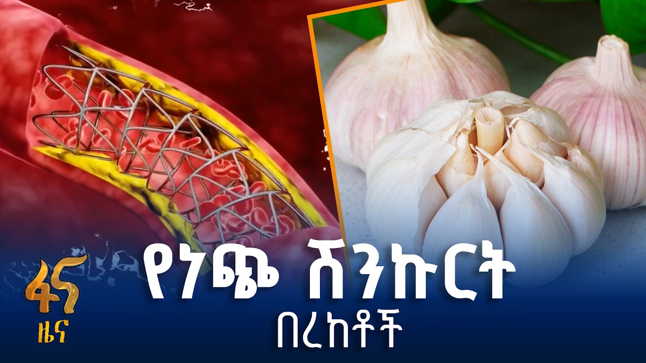 የነጭ ሽንኩርት የጤና ጥቅሞች