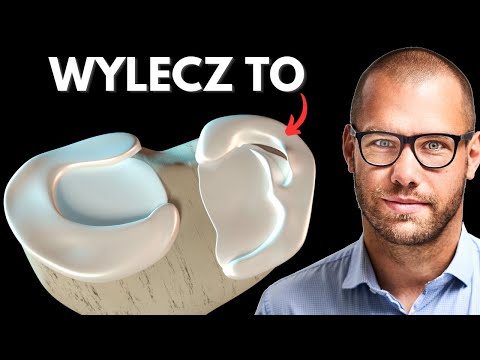 Uszkodzenie Łąkotki - Wszystko co musisz wiedzieć!