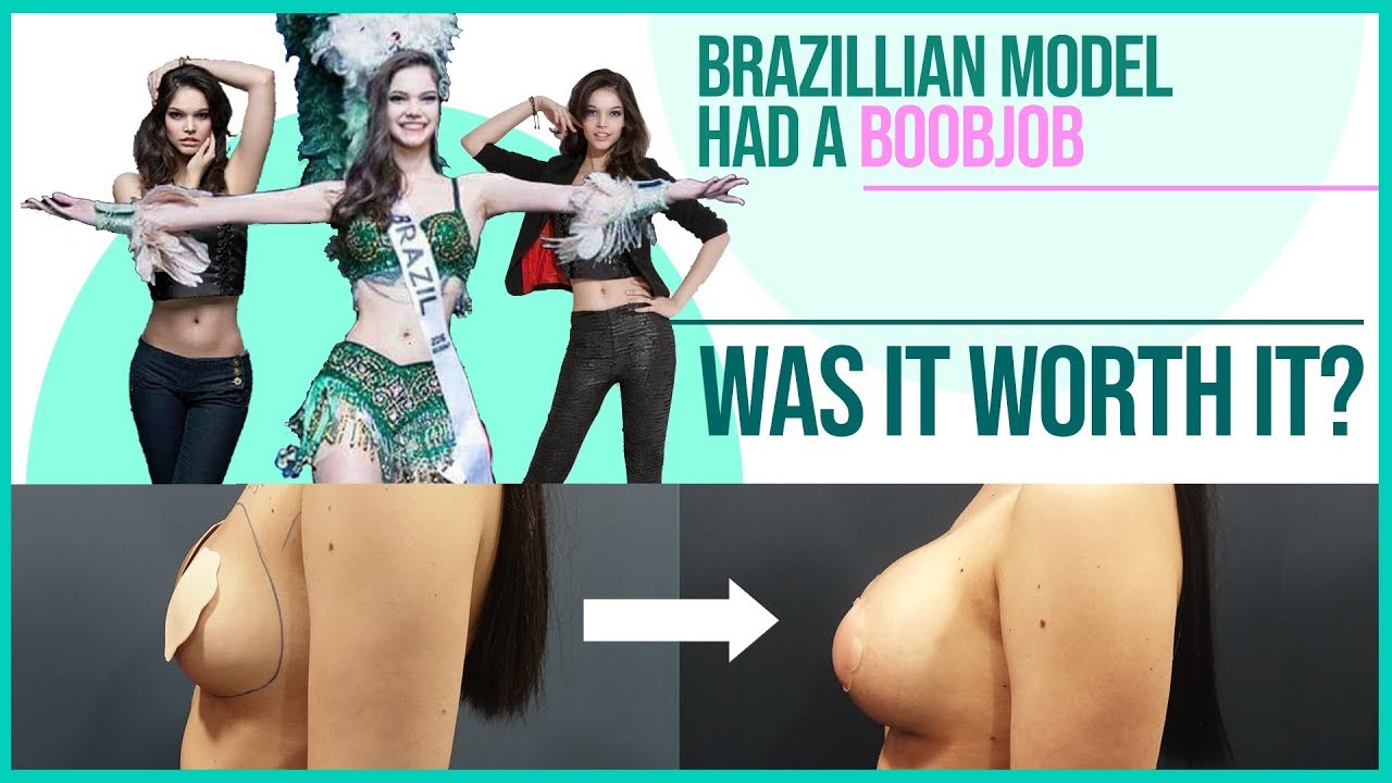 Patient Story Thumbnail